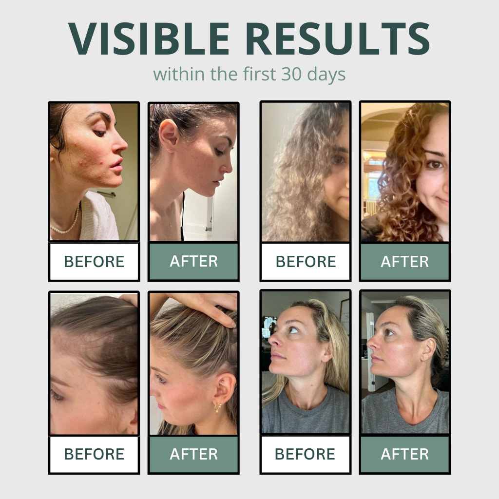 Start the Year Without Dryness or Itching After Every Shower with VYTA™