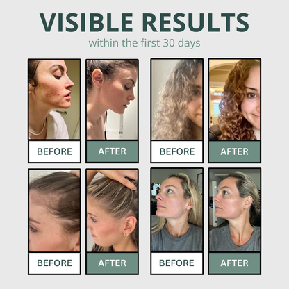 Start the Year Without Dryness or Itching After Every Shower with VYTA™